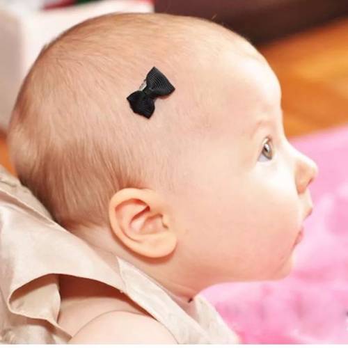 2 Adet Kırmızı Siyah Yenidoğan Bebek Tokası Zayıf İnce Telli Saçlara özel Çıtçıtlı Saç Aksesuarı